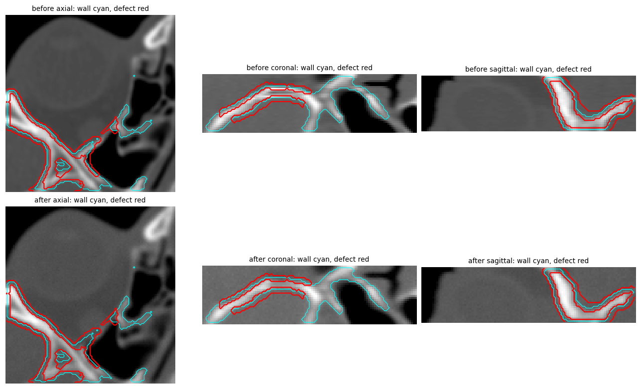 Phase D before/after defect overlays