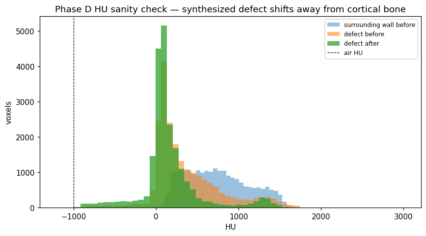 Phase D HU sanity histogram